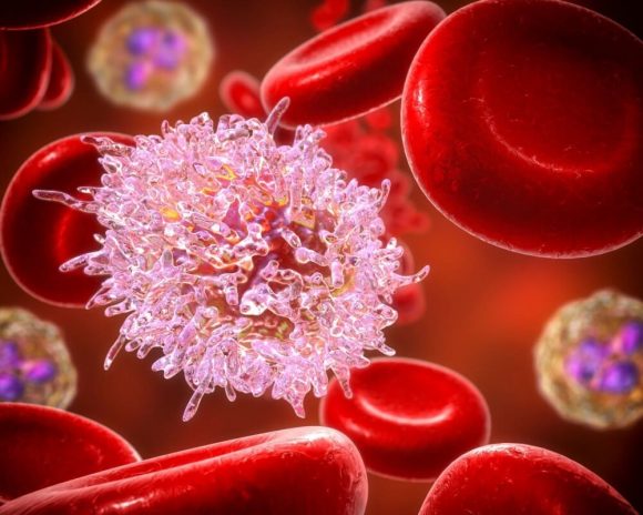 losemi-leukemia